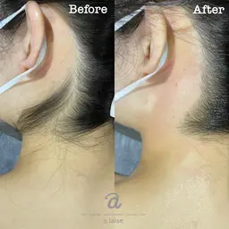 [女性]ワックス　VIO・うなじ・背中セット