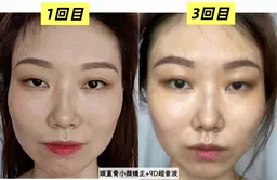 速攻小顔【頭蓋骨小顔矯正+9D超音波】 45分