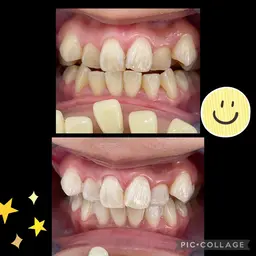 【新価格】初回スタンダードコース 9分光を3セット