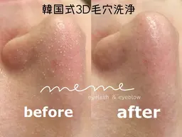 SNSで話題🤍韓国式3D毛穴洗浄𓂃 𓈒𓏸◌‬