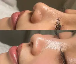 フェイスワックスお試し🫧部分（おでこ、口周り、眉毛周り、フェイスライン）のパーツ🖐️2箇所から選べる