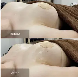 【オープン記念】最新NR機器を使用❣️✨結果重視でぷるふわバストアップケア❣️