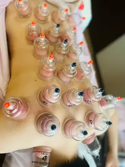 ☯️全身カッピング＋マッサージ☯️