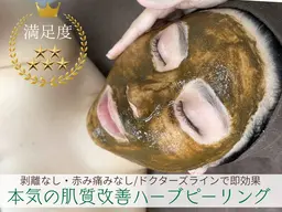 【期間限定💖】大人気♡ハーブピーリング🌿（全顔）¥4,000❣️国産×ドクターズラインで一回でも即効果あり✨