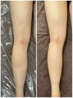 ミニモ限定🩵２０代女性限定【全身マッサージのエステ】PMSや肩こりや冷え性が気になる方にも🌿男性不可です