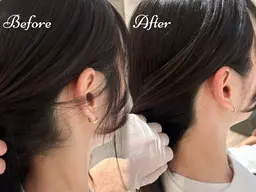 うなじワックス脱毛＋光脱毛照射 ¥7,000→¥4,000