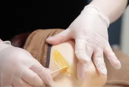 全顔 WAX脱毛