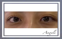 ラッシュリフト　※補足を必ずお読み下さい。