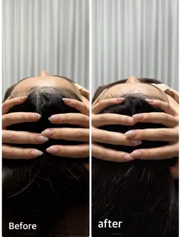 大人気！！【究極の小顔コース！！】頭蓋骨矯正付き100min❣️【¥22,000→¥4,950】