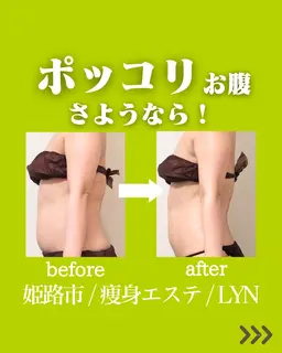 【お腹のくびれ✨美脚💃が叶う】痩身エステ無料カウンセリング🌿‬その日に体験可能☆