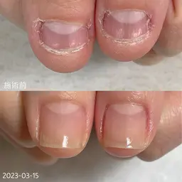 最強のネイルケア１回体験