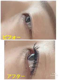 フラットラッシュ140本