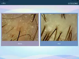 【1日1名様限定】SNS用動画撮影モデル募集中!