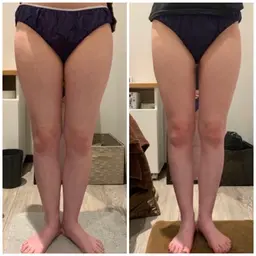 【本気の痩身エステ】燃焼/本気のスリムアップ体験（下半身）キャビテーション