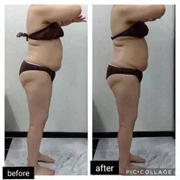 骨盤矯正付き☆オールハンド筋膜リリース痩身エステ120分 １ヶ月以内再来限定20％off