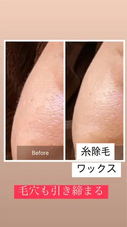 フェイスWax（2ヶ月以内）