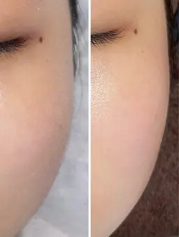 フェイシャル美肌ワックス