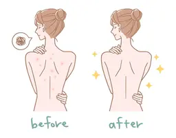 ウエディング専用お背中ピーリングコース