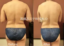 【くびれ】先着限定2名様価格♡オールハンドインド式痩身ウエスト贅肉撃退コース