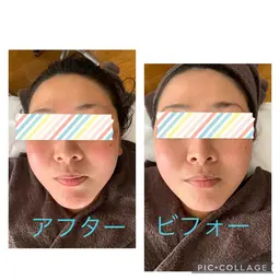 フェイシャルリラックスコース