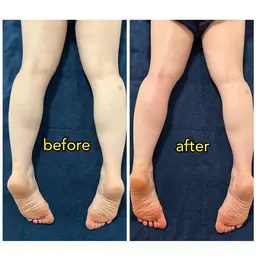 ミニモ学割！骨盤の歪みも整えてむくみ解消！一回で華奢見え脚！！冬のブーツもキレイに履ける！骨盤矯正✖️リンパマッサージ！