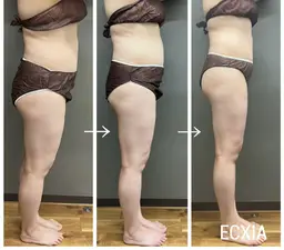 【最強痩身☆】ベーシックオールハンド痩身エステ！全身にアプローチ！人気メニュー♪1番人気メニュー⭐︎