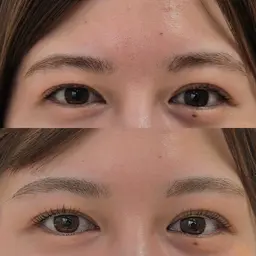 【3月限定】ラッシュリフト+眉毛ワックス