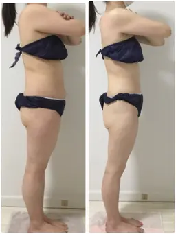 【結果重視🔥】強圧リンパ痩身90分✨ 全身セルケア×脂肪大掃除で即効スッキリ感を実感◎