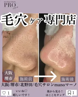 【当店1番】人気毛穴美人コース