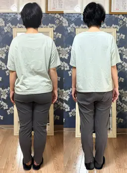 骨盤矯正【お尻たるみ改善・大転子・横張・反り腰】土台から美しくする整体