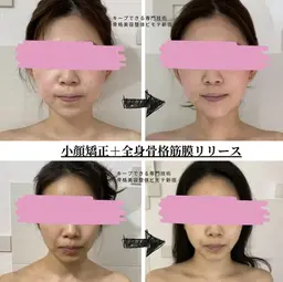 新規女性限定🍀ボディトリートメント/美小顔/肩こり/腰痛/痩身/バストケア✨【全身骨格筋膜リリース＋小顔矯正】120分