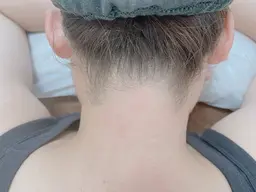 シュガーリング　うなじ