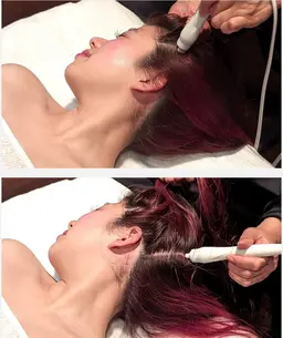 頭皮の毛穴汚れを頭スッキリデトックス✨ハイドロ頭皮洗浄+ドライヘッドマッサージ60分👐