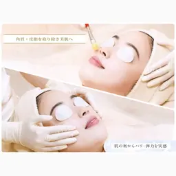 ≪毛穴+ニキビダブルケア≫美肌の土台づくり/毛穴洗浄&ビタミン導入ダブルピ－リング 【毛穴黒ずみ・開き｜ニキビ(跡)】