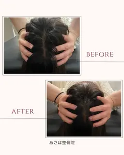 【眼精疲労や自律神経の乱れに】ドライヘッドスパ 30分5,500円