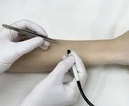 【毛を1本1本脱毛　15分間】　　※眉毛、白髪、硬毛がした毛、デザイン脱毛などにオススメ◎