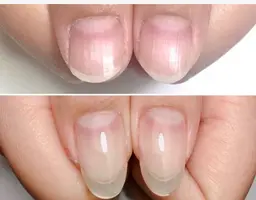 美爪育成 ケア＆クリア お試し