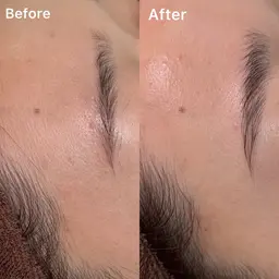 HBL+お顔剃り(フェイスシェービング)💎✨