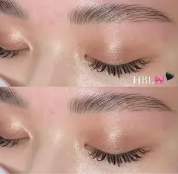 HBL(ハリウッドブロウリフト)