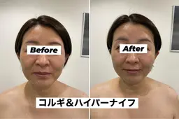 ハイパーナイフ&コルギフェイシャル70分モニター