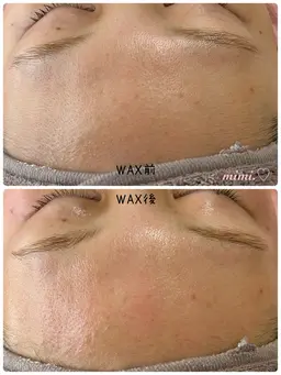 《2月限定》フェイシャルワックス