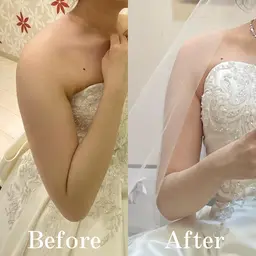【マタニティ】妊娠中でも美しく◎ブライダル痩身ケア　60分