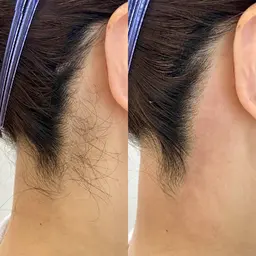 うなじシェービング