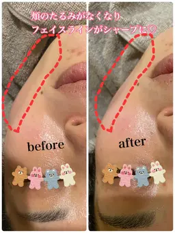 小顔フェイシャルマッサージ♪ 凝り固まった筋肉を緩め元の位置に戻す事で、シワやたるみの改善、リフトアップで小顔効果も！