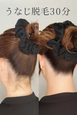 【後ろ姿まで盛れる✨学生にも大人気💛垢抜け確定🔥美背中＆うなじ脱毛💖】背中＆うなじ脱毛🍑 3,980円