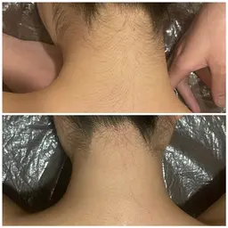 ミニモ限定⭐️ミニモ学割⭐️【脱毛】ワキ脱毛無料体験+脱毛カウンセリングクーポン✨