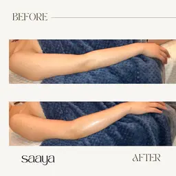 上半身痩身ケア 浮腫/たるみ/冷え性/肩こり/腰の痛み