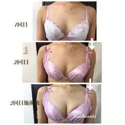 育乳・美バストトリートメント【新規様特別価格】