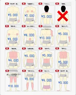 メンズ全身脱毛✨顔無し