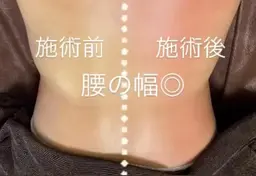 【痩身】60分施術🔥気になる箇所を徹底アプローチ‼️オーダーメイド半身 キャビ、ラジオ、バキューム、マッサージ